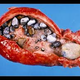 Illustration for article titled Obat-Obat Batu Ginjalem/em